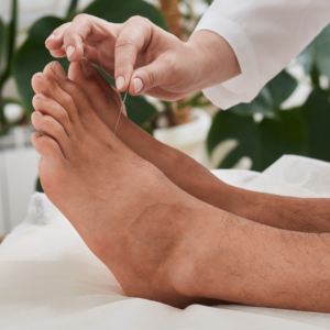 Acupuntura 4 tratamento para dor ciática