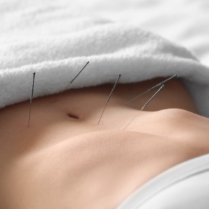 Acupuntura_10 tratamento para climatério com acupuntura