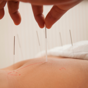 tratamento para alergias