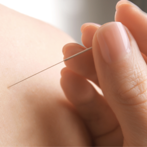 tratamento para insônia com acupuntura