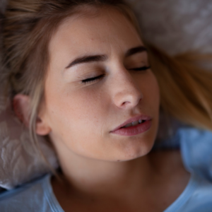 Bruxismo_3 Bruxismo 3