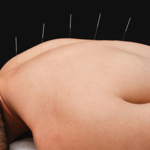 tratamento para dor na lombar