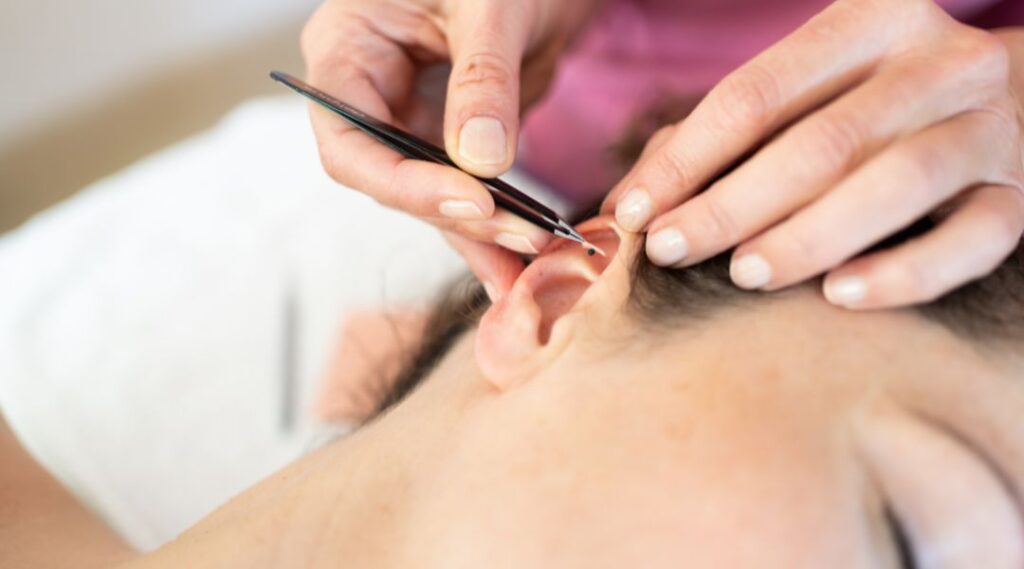 Auriculoterapia: 3 motivos pelo qual você deveria fazer 4 a