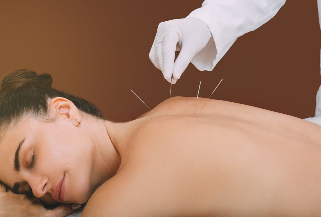 7 Benefícios da Acupuntura: Como Esta Prática Milenar Pode Transformar Sua Saúde 3 veja os Beneficios da acupuntura